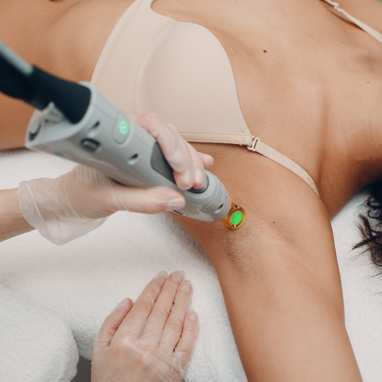 Laser Hair Removal Laser Hair Removal